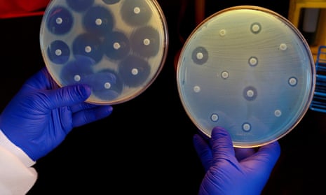 A CDC researcher holds up two culture plates growing bacteria in the presence of discs containing various antibiotics. The isolate on the left plate is susceptible to the antibiotics on the discs and is therefore unable to grow around the discs. The one on the right has a CRE (Carbapenem-resistant Enterobacteriaceae) that is resistant to all of the antibiotics tested and is able to grow near the disks