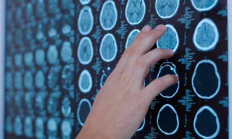 Brain scans on a board