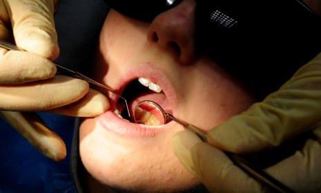 close up of a dentist examining a patient