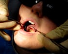 Fake dentist charged by Czech police after treating dozens of patients
