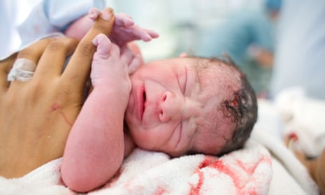 Experts writing in the British Medical Journal say the practice of ‘seeding’ after caesarean births could put babies at risk.