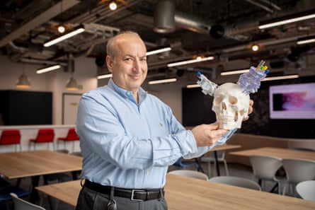 Dr David Cooper holding a replica human skull with medical equipment used for the gene therapy attached.