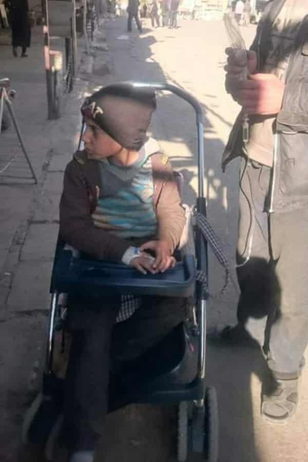 A boy being pushed in a buggy in Madaya. Activists say many people in town are too weak to walk.