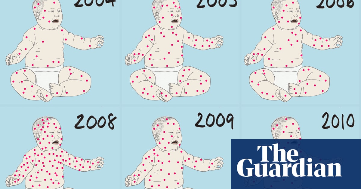 How measles outbreaks have spread amid the antivaccine movement MMR