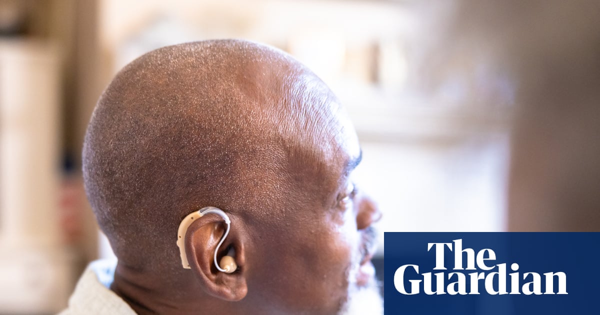 Hearing Loss Reduces Employment Opportunities Across US Populations