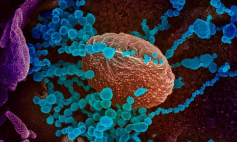 Electron microscope image of SARS-CoV-2 virus