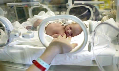 Premature baby in ICU