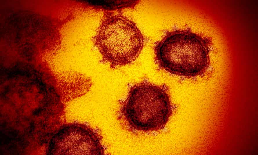An electron microscope image from the US National Institutes of Health of SARS-CoV-2, the virus that causes Covid-19.
