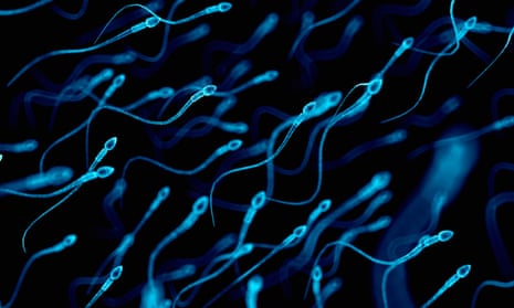 An illustration of several human sperm cells.