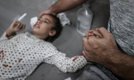 A child being cared for on the floor of al-Shifa hospital in northern Gaza.