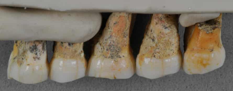 Some of the teeth that were found belonging to Homo luzonensis.