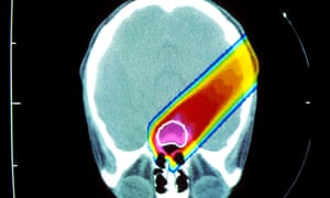 theguardian - universities-raise-alarm-over-no-deal-brexit-and-eu-student-enrolment https://www.theguardian.com/education/2019/jan/04/universities-raise-alarm-over-no-deal-brexit-and-eu-student-enrolment