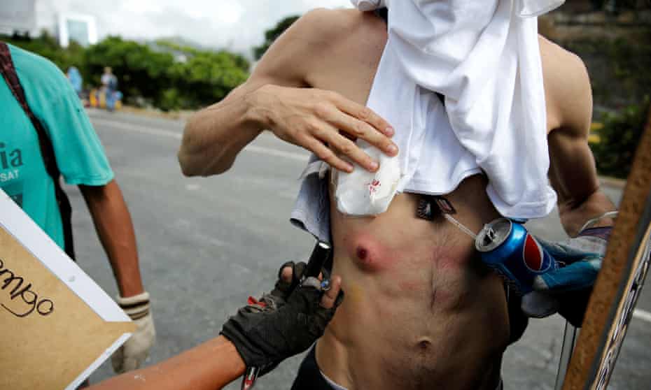 Injured protester
