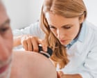 Melanoma skin cancer cases in UK hit record level, analysis finds