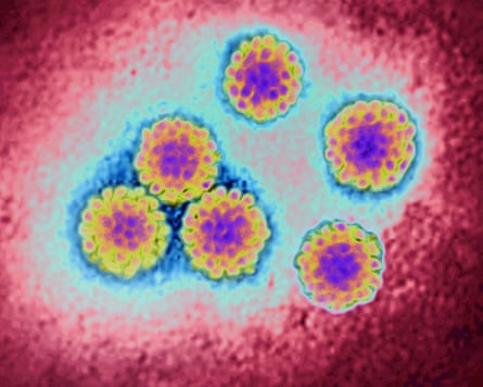 Human papillomavirus under the microscope