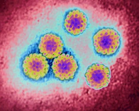NHS England to offer women 'gamechanging' free home testing kits for cervical cancer | Cervical cancer | The Guardian