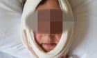 Melbourne jaw surgeon may face legal action from second patient alleging negligence