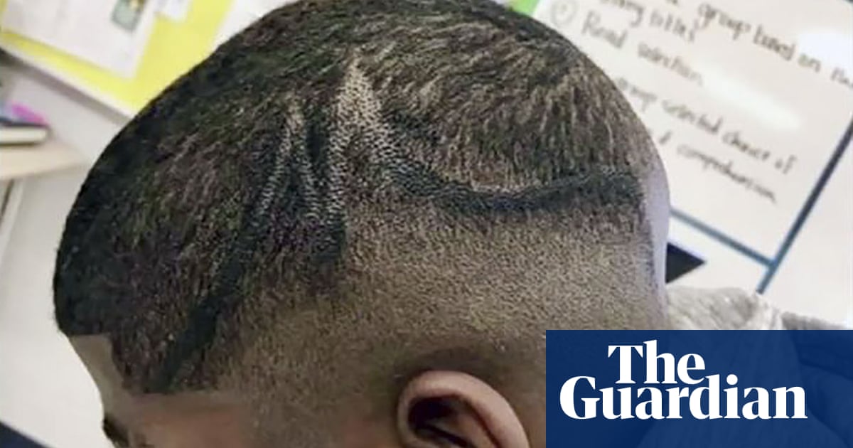 I Was Shocked Mother Of Boy Whose Scalp Was Coloured By School