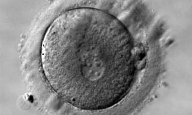 A human zygote at 18-20 hours after insemination