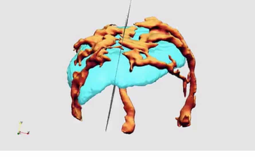 Placenta image