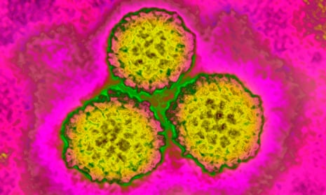 The human papillomavirus causes cervical cancer. 