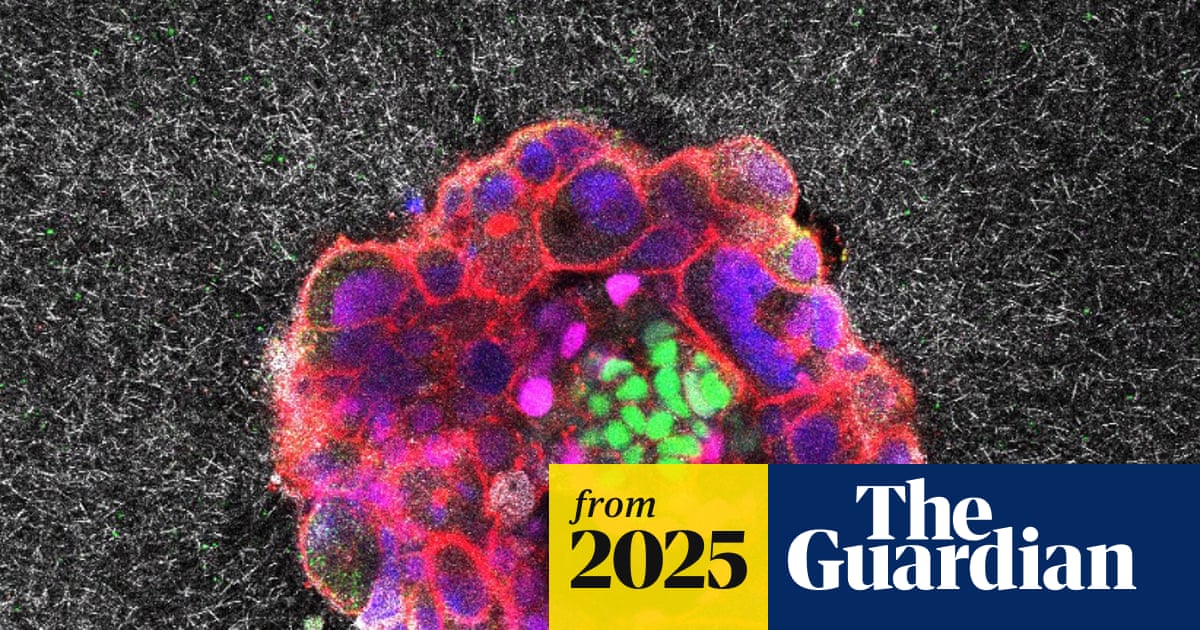 Scientists capture first footage of human embryo implanting in a uterus