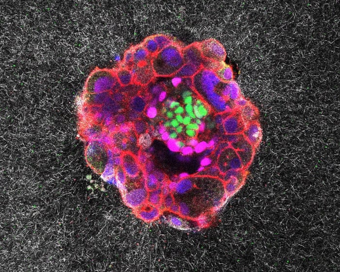 Scientists Capture Historic Footage of Human Embryo Implantation