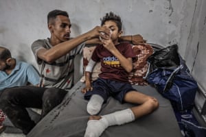 A man helps a heavily bandaged boy drink from a cup