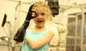 Tilly Lockey and her bionic hand