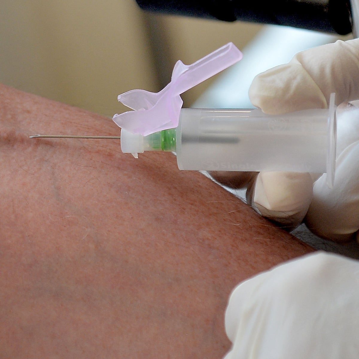 Thousands Recalled For Hepatitis C Test After Nhs Worker S Diagnosis Hepatitis C The Guardian Thousands Recalled For Hepatitis C Test After Nhs Worker S Diagnosis Hepatitis C The Guardian