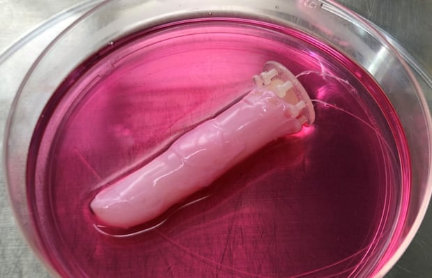 A robotic finger, covered in living skin, sits in a petri dish