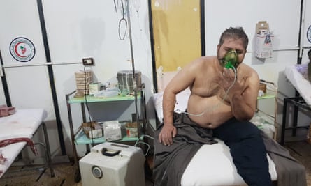 A man receives treatment in hospital after the alleged gas attack in eastern Ghouta.
