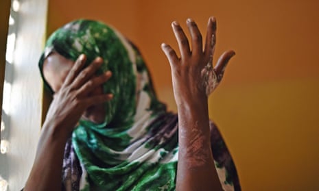 An 18-year-old victim of forced marriage in Somalia