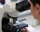 AI Test Halves Prostate Cancer Death Risk in High-Risk UK Patients