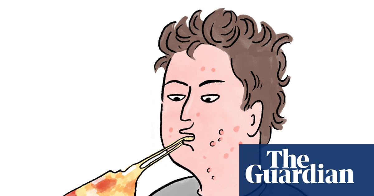 Is it true that eating greasy food causes spots?