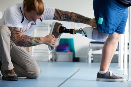 Kane having a new prosthetic leg fitted at Pace Rehabilitation in Stockport.