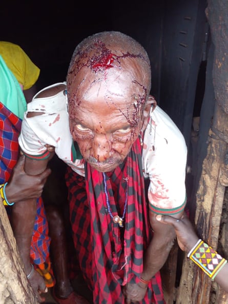 A Maasai protestor with a head wound