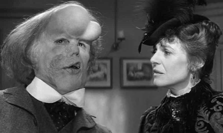 John Hurt et Anne Bancroft dans The Elephant Man.