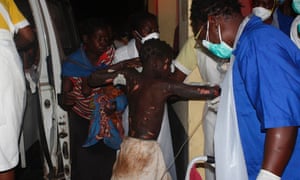 A badly injured person arrives at Tete hospital following a fuel-truck explosion