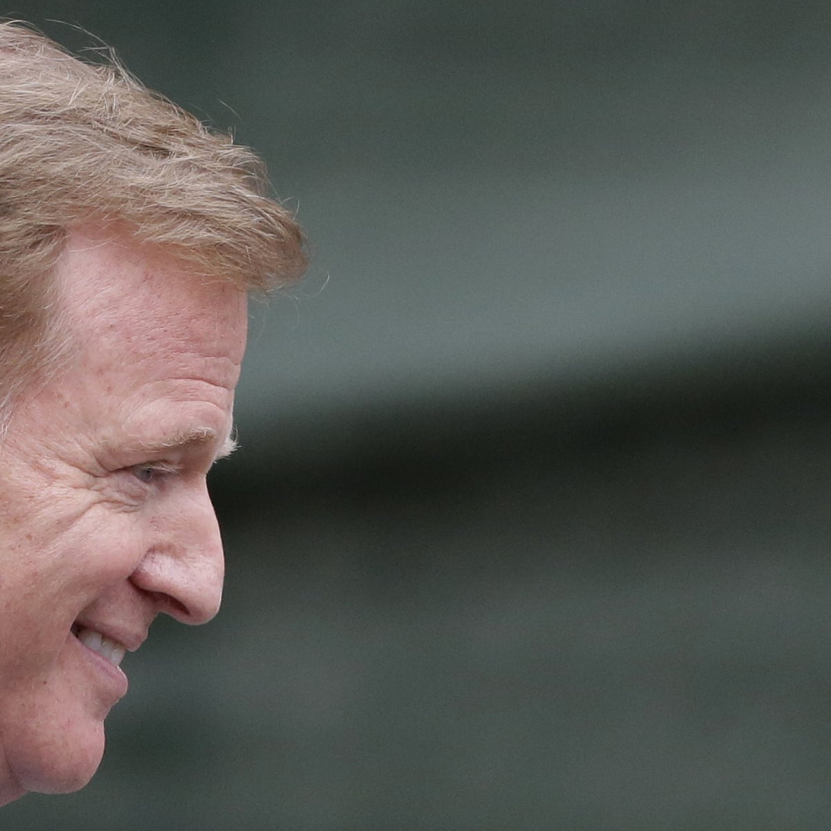 Fit For Rivals Lead Singer Hairstyle In Damage