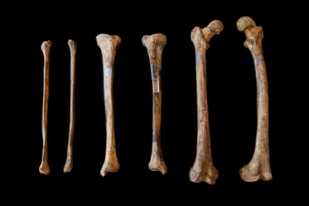 A display of bones