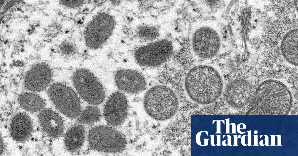 ‘Now we have to deal with it’: what’s going on in the UK with monkeypox?