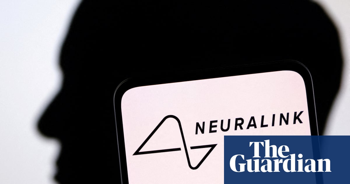 elon-musk-s-brain-implant-company-is-approved-for-human-testing-how-alarmed-should-we-be