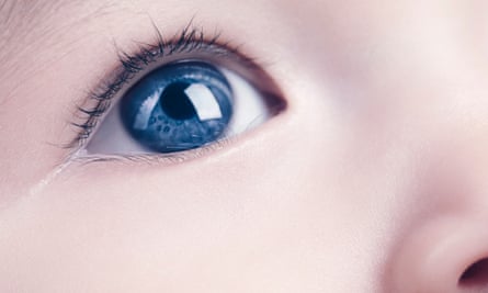 Children With Cataracts Regain Sight After Radical Stem Cell Treatment Stem Cells The Guardian