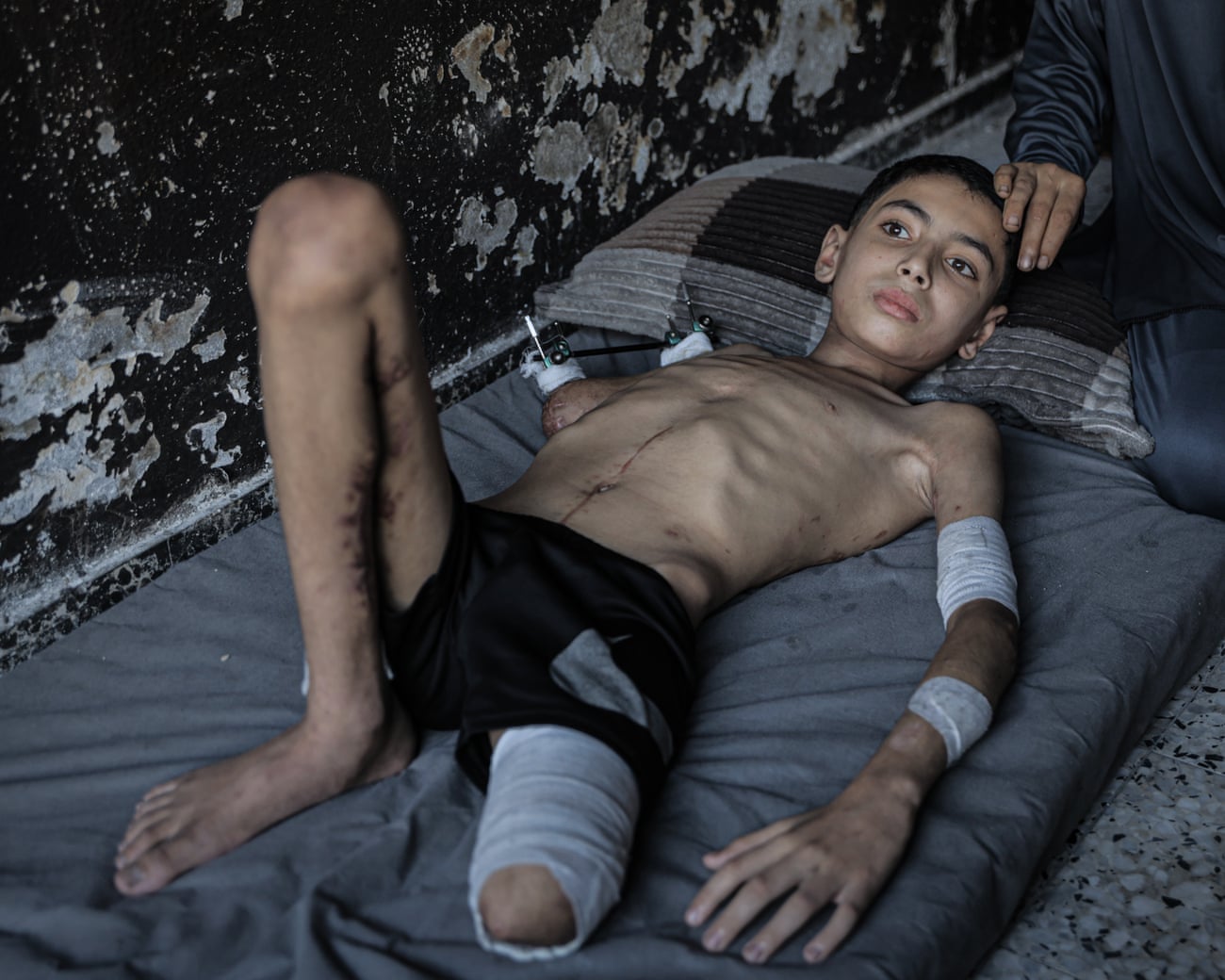 Gaza children denied visas
