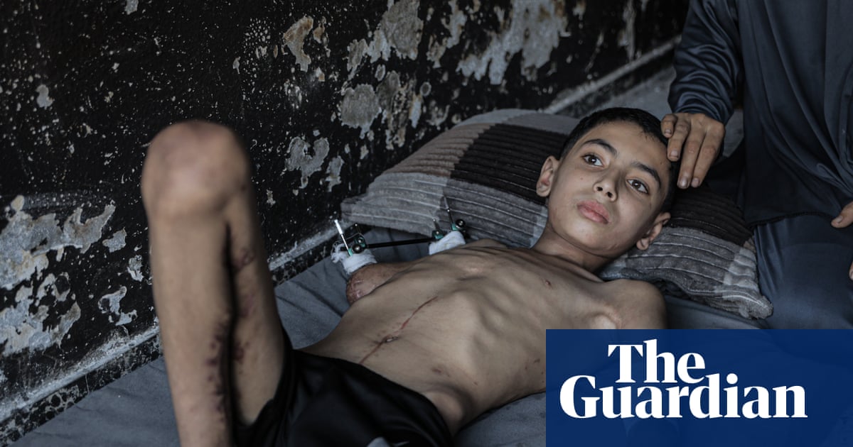 US state department stops issuing visas for Gaza's children to get medical care after far-right campaign
