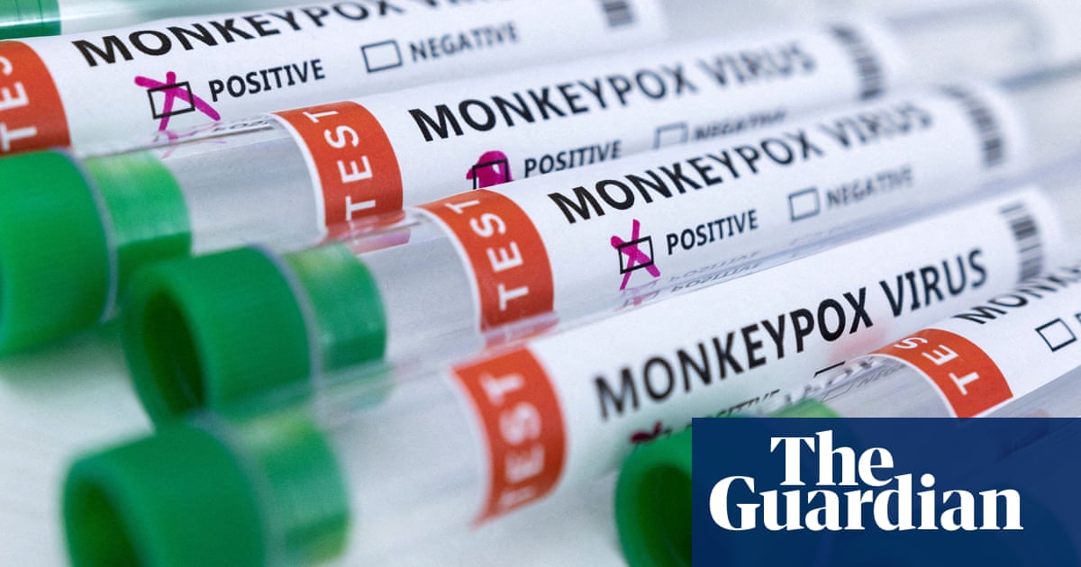 Beware delays in monkeypox test results