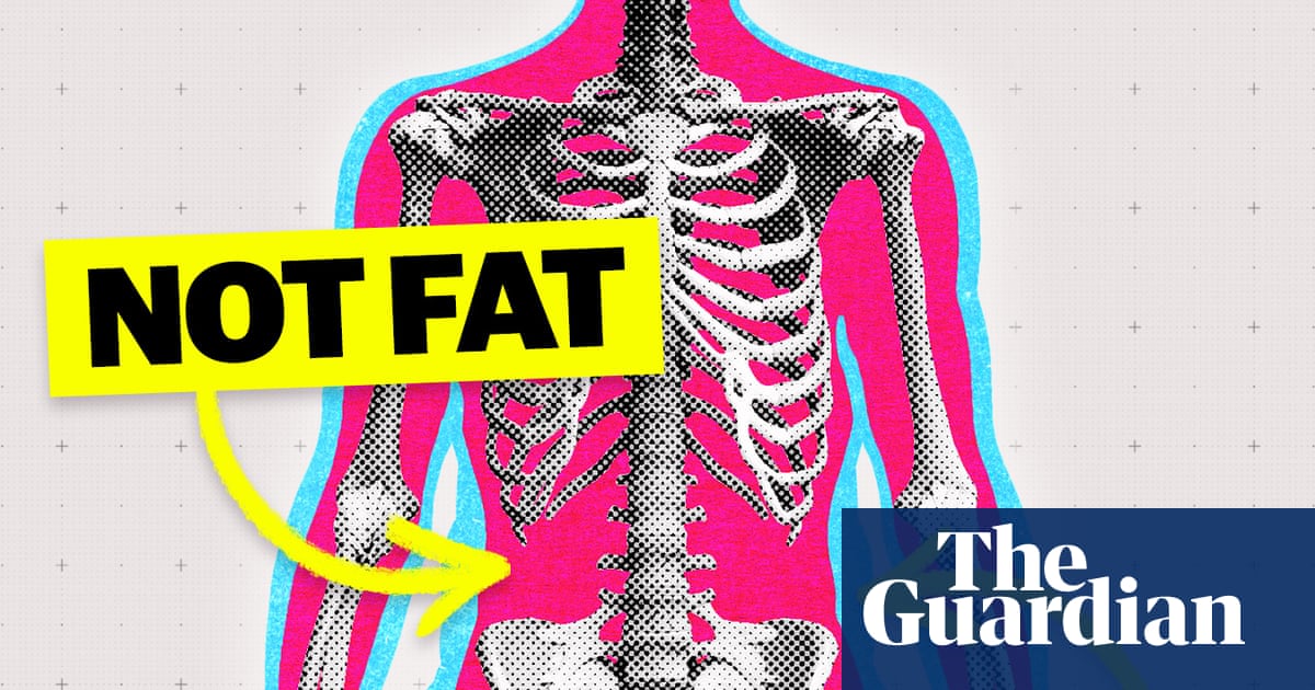 'I've lost my butt': how rapid weight loss can leave you with less muscle and more fat