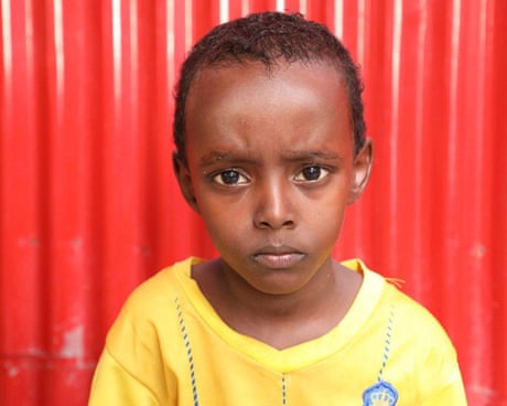 Seven-year-old Abdiqadir was hit in a US airstrike. Without a $750 operation, he may lose his ability to walk