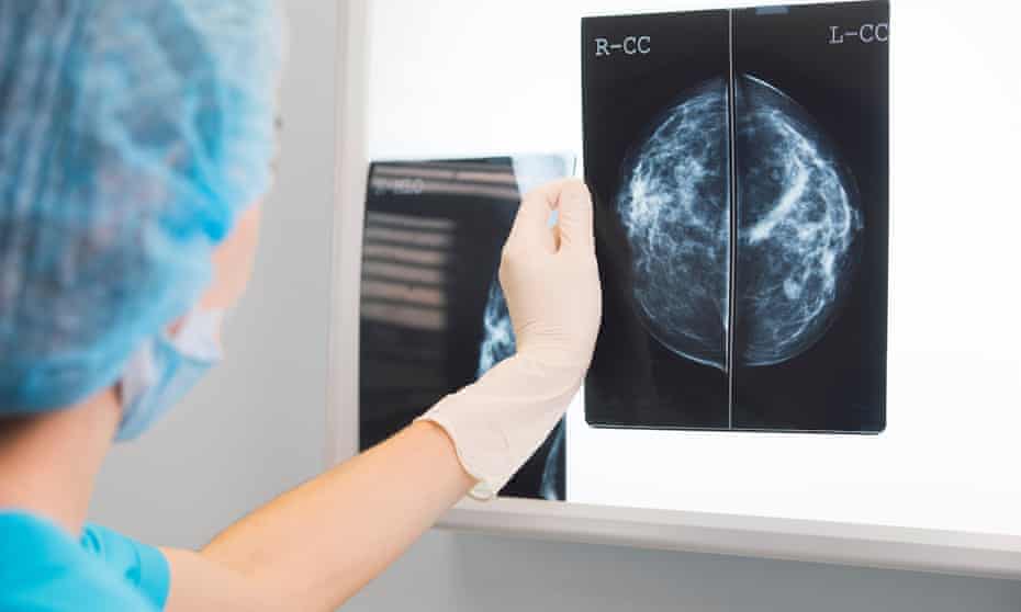 A doctor holds a mammogram.